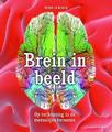 Brein in beeld
